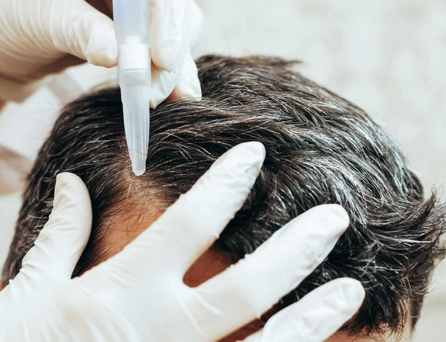 Scalp Stimulation