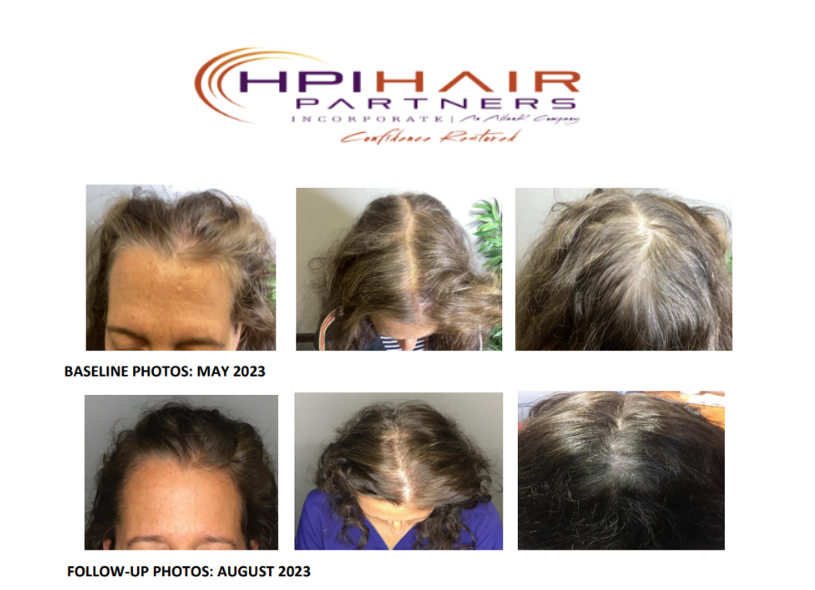 Rene Furterer Triphasic Strengthening Shampoo