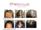 Rene Furterer Triphasic Strengthening Shampoo
