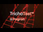 TrichoTest™ Genetic DNA Test for Hair Loss